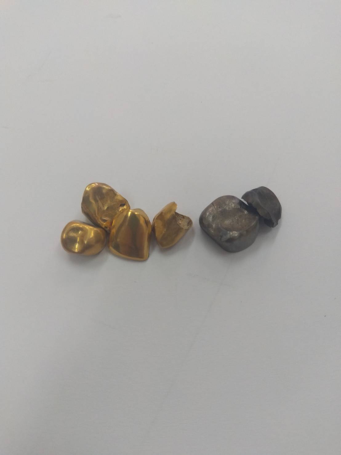 貴金属 金歯 銀歯